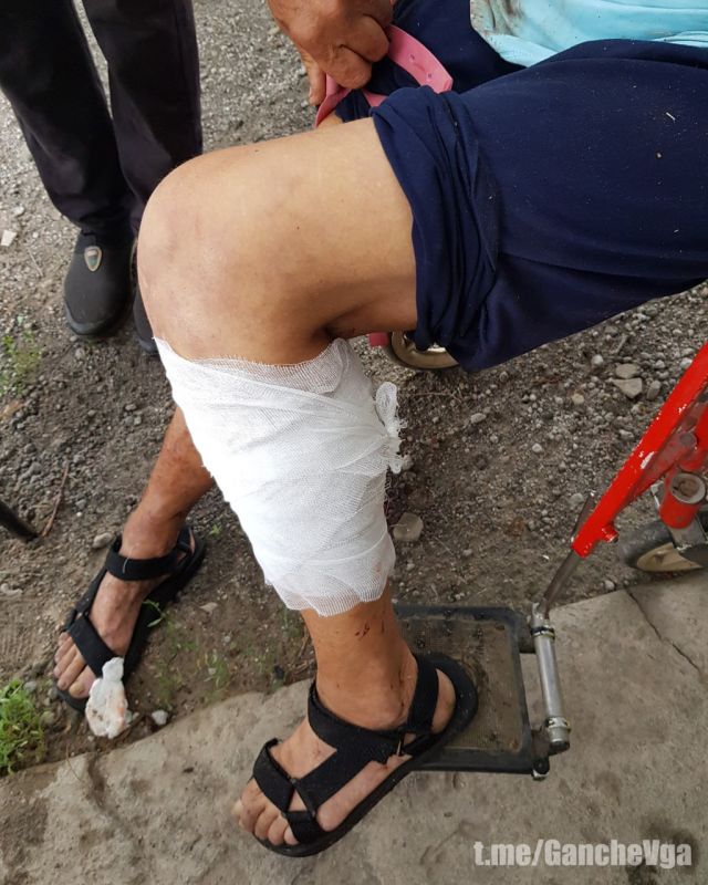 В результате дистанционного минирования одной из автодорог Харьковской области, осуществленного украинскими вооруженными формированиями с применением БПЛА, трое гражданских лиц (двое мужчин и женщина) получили ранения... В результате дистанционного минирования одной из автодорог Харьковской области, осуществленного украинскими вооруженными формированиями с применением БПЛА, трое гражданских лиц (двое мужчин и женщина) получили ранения...