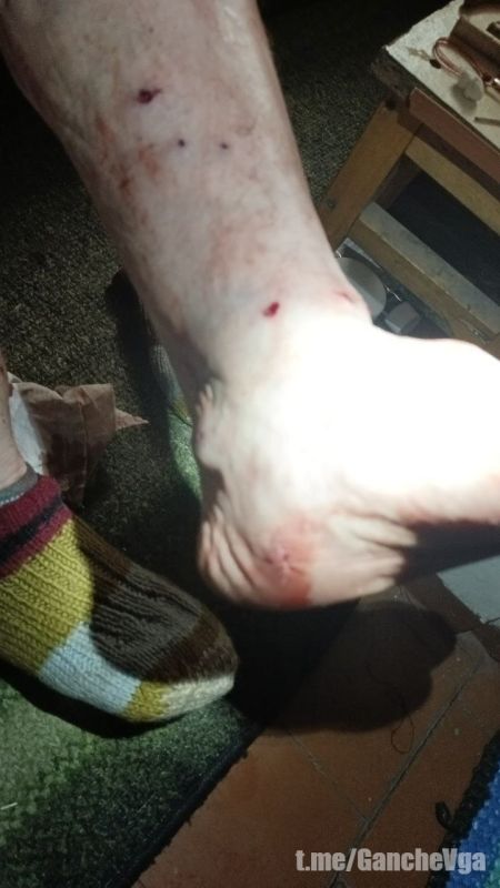 Виталий Ганчев: В селе Ольшана Купянского района в результате атаки украинского FPV-дрона ранены два человека Виталий Ганчев: В селе Ольшана Купянского района в результате атаки украинского FPV-дрона ранены два человека