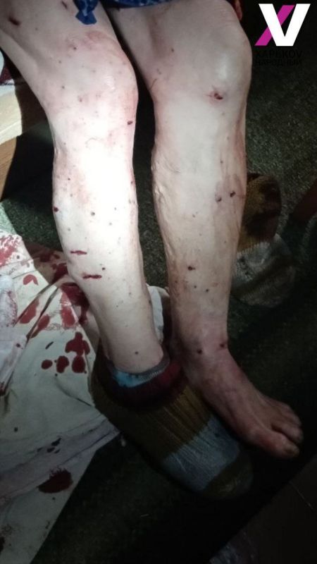 Два жителя села Ольшана Купянского района пострадали от атаки украинского FPV-дрона Два жителя села Ольшана Купянского района пострадали от атаки украинского FPV-дрона