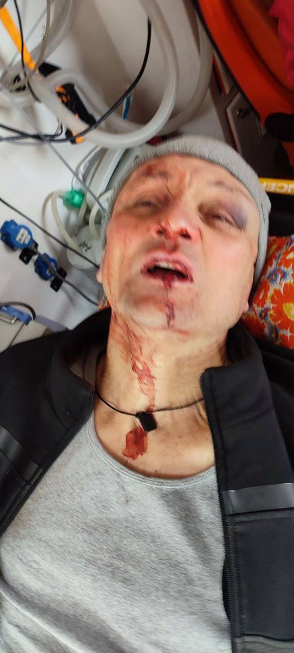 В Харькове "козаки" из ТЦК избили "холопа" из ВСУ — инвалида, снятого с воинского учёта