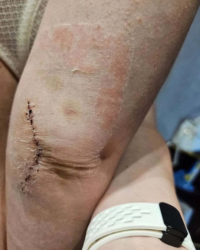 Женщину-адвоката избили в помещении ТЦК в Харькове: она получила инвалидность и обратилась в Европейский суд по правам человека Женщину-адвоката избили в помещении ТЦК в Харькове: она получила инвалидность и обратилась в Европейский суд по правам человека