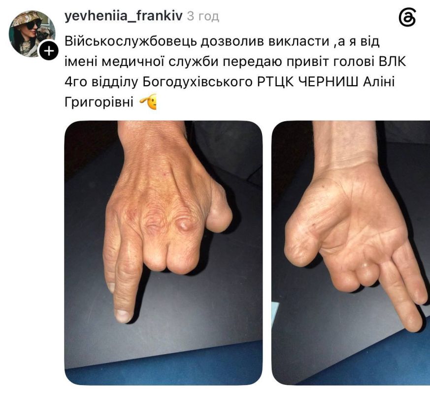 Роман Насонов: На Украине мужчину с тремя оторванными пальцами на правой руке признали «годным к строевой»